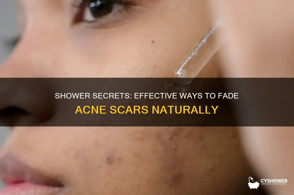 how to get rid of acne scars in the shower