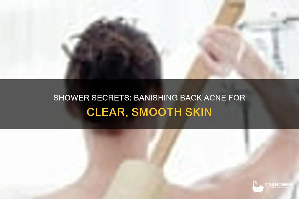 how to get rid of back acne in the shower