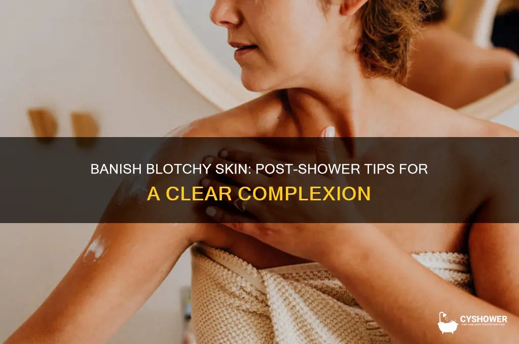 how to get rid of blotchy skin from shower