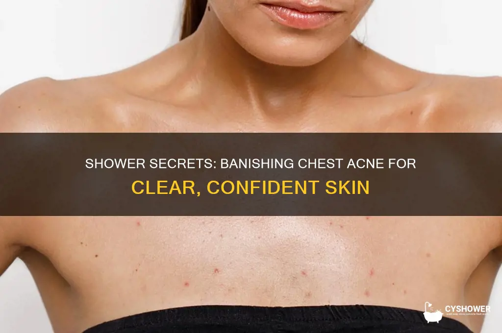 how to get rid of chest acne in the shower