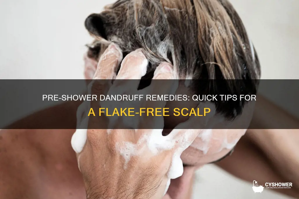 how to get rid of dandruff before shower