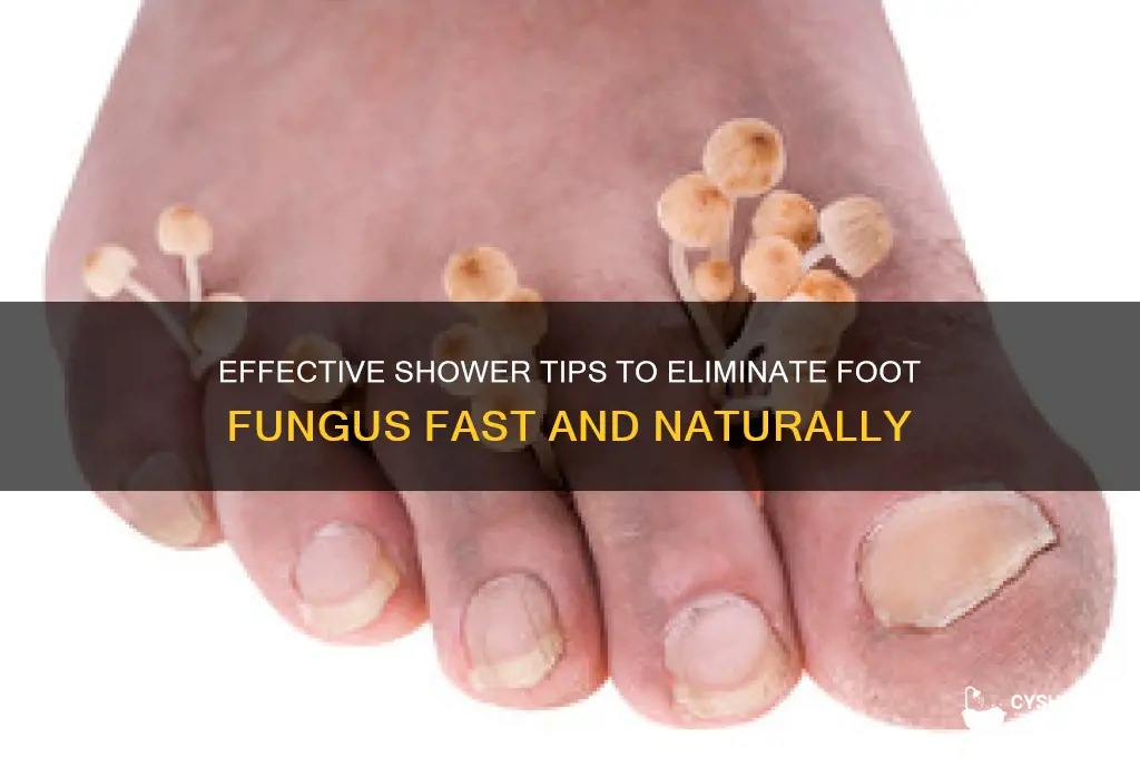 how to get rid of foot fungus in shower