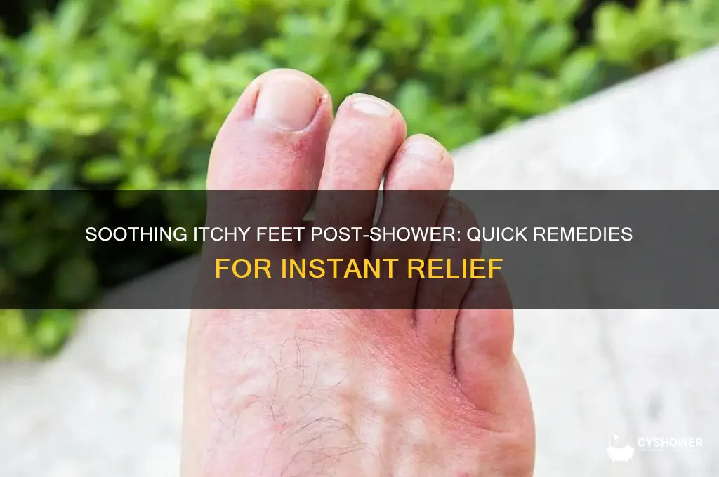 how to get rid of itchy feet after shower
