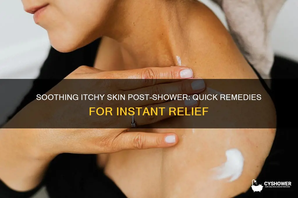 how to get rid of itchy skin after shower