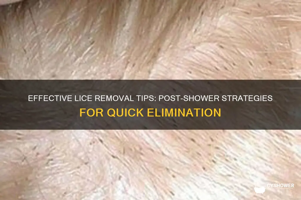 how to get rid of lice after 1 shower
