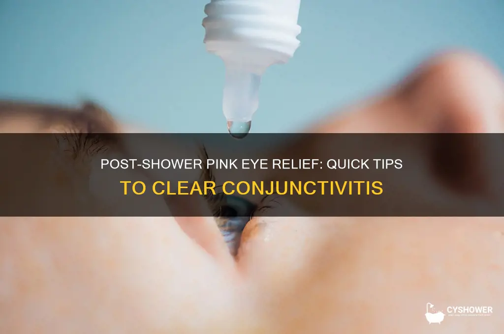 how to get rid of pink eye after a shower