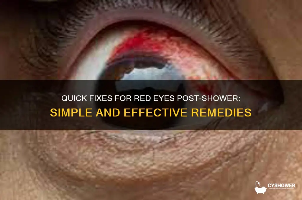 how to get rid of red eyes after shower