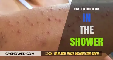 Shower Secrets: Effective Zit-Busting Tips for Clearer Skin Fast