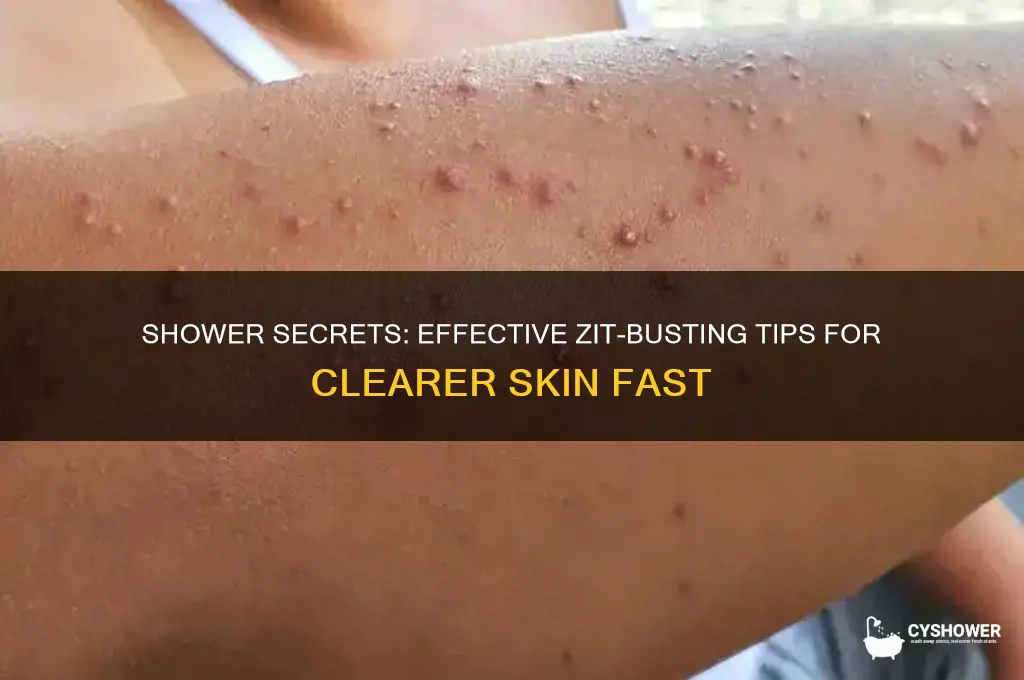 how to get rid of zits in the shower