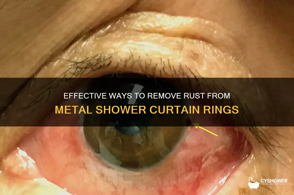 how to get rust off metal shower curtain rings