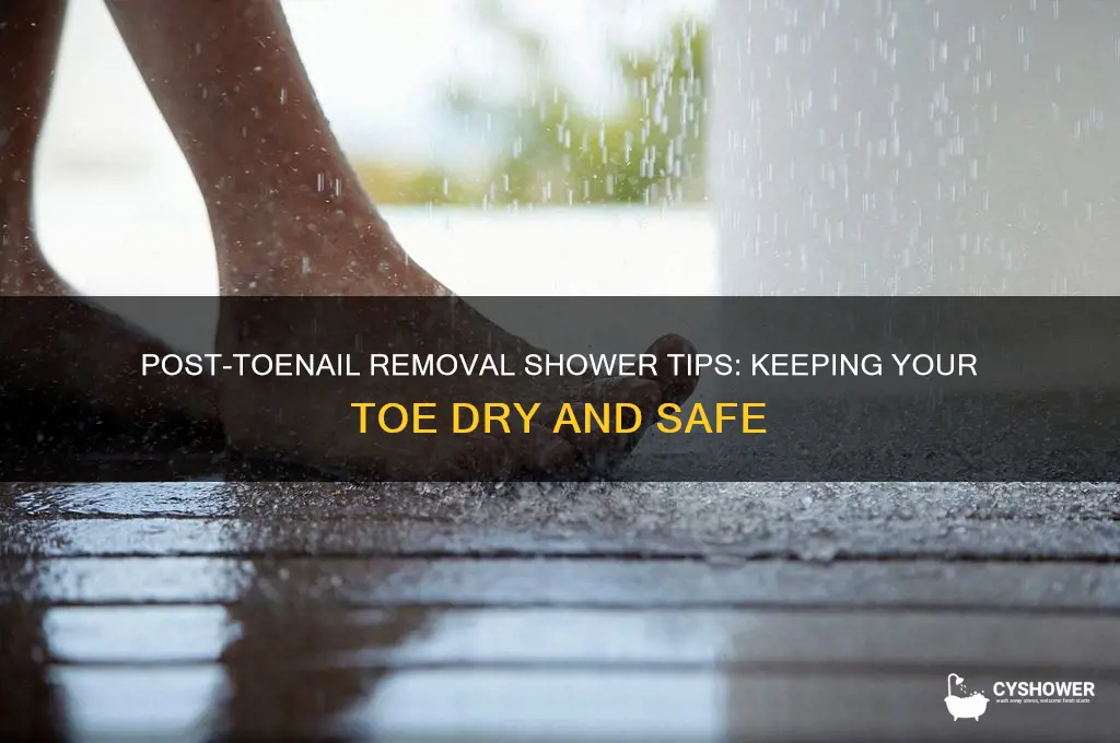 how to keep toe dry in shower after toenail removal
