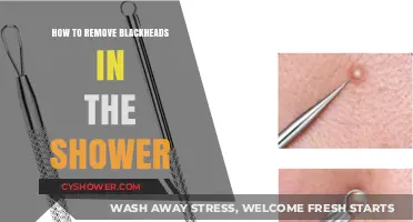 Shower Secrets: Effective Blackhead Removal Tips for Clearer Skin