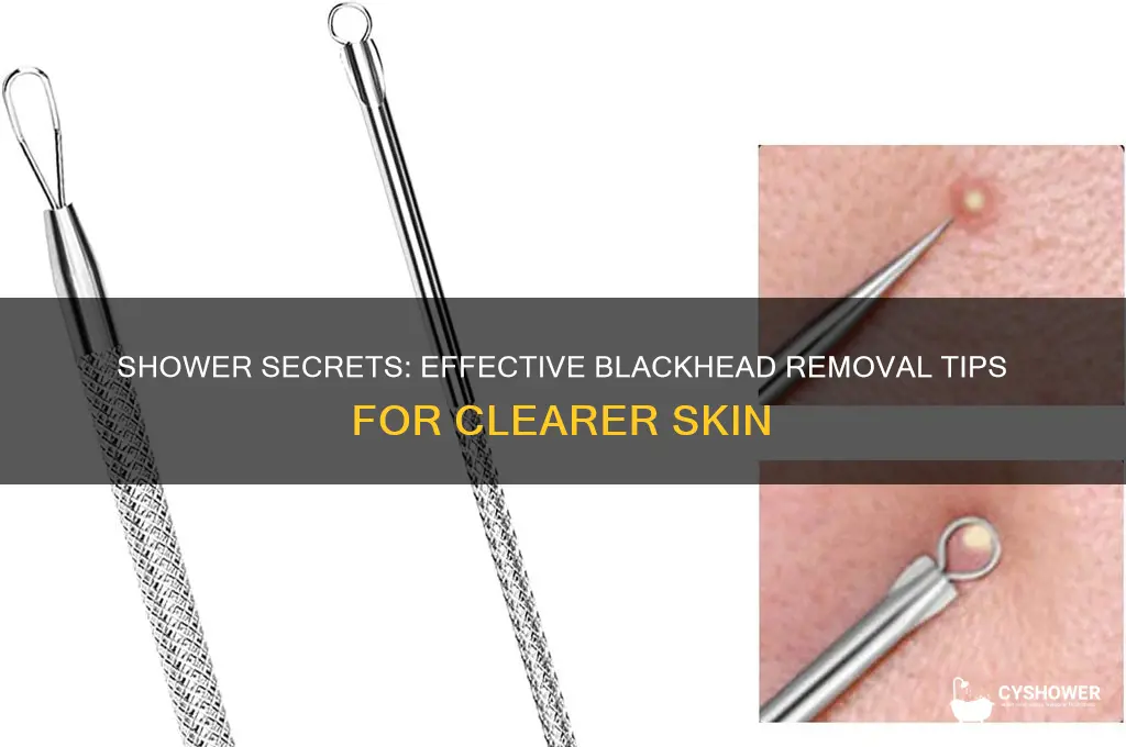 how to remove blackheads in the shower