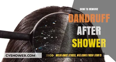 Post-Shower Dandruff Solutions: Effective Tips for a Flake-Free Scalp