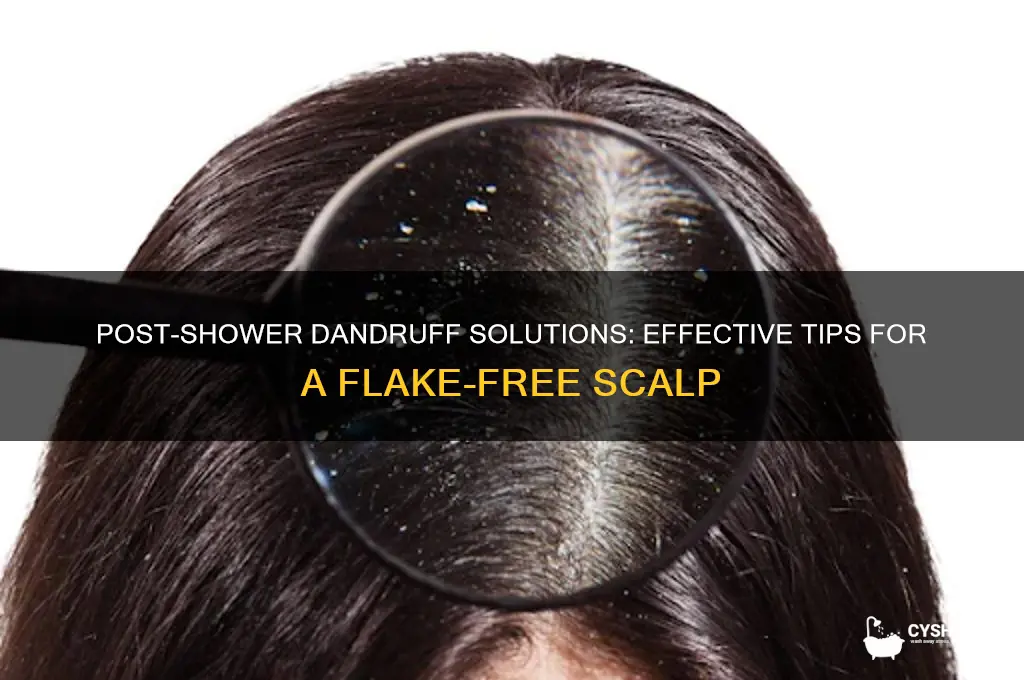 how to remove dandruff after shower