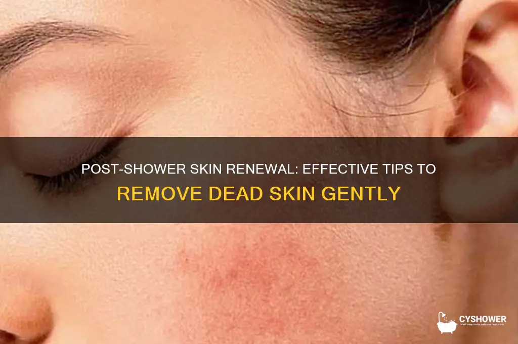 how to remove dead skin after a shower