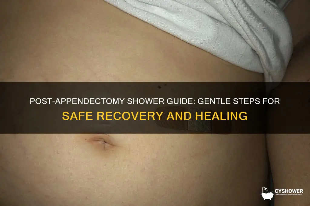 how to shower after appendix removal