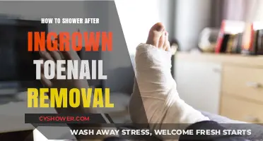Post-Ingrown Toenail Removal Shower Guide: Gentle Healing Tips for Clean Recovery