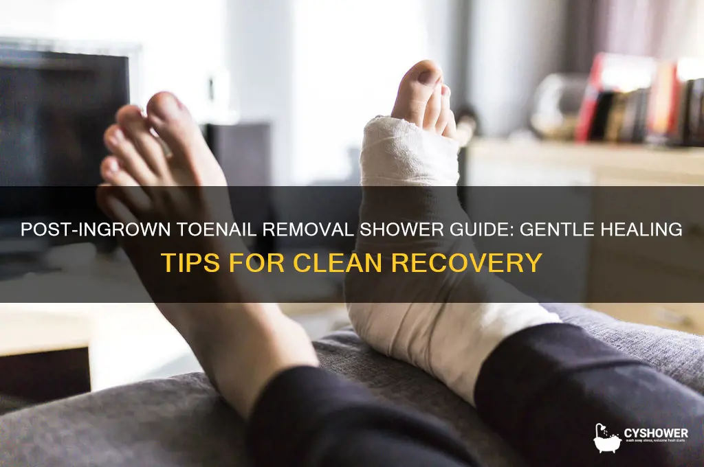 how to shower after ingrown toenail removal