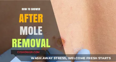 Post-Mole Removal Shower Guide: Gentle Care for Healing Skin