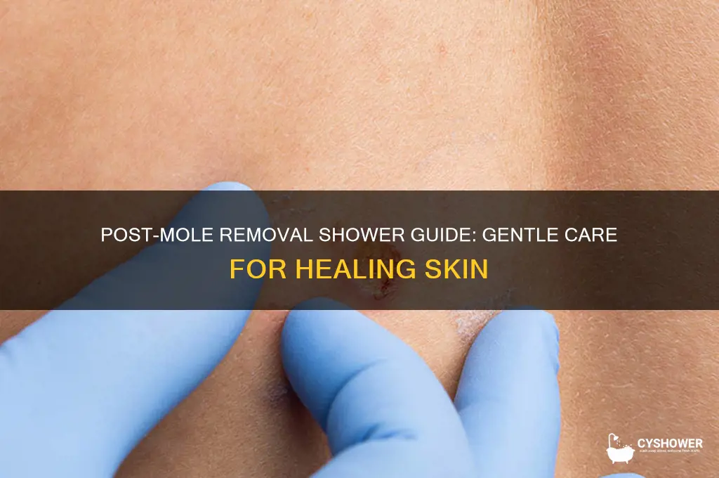 how to shower after mole removal