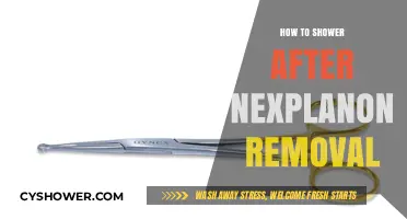 Post-Nexplanon Removal Shower Guide: Gentle Care for Healing Skin