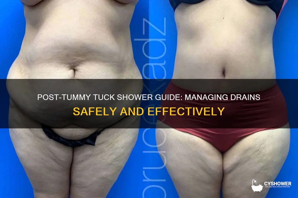how to shower after tummy tuck with drains
