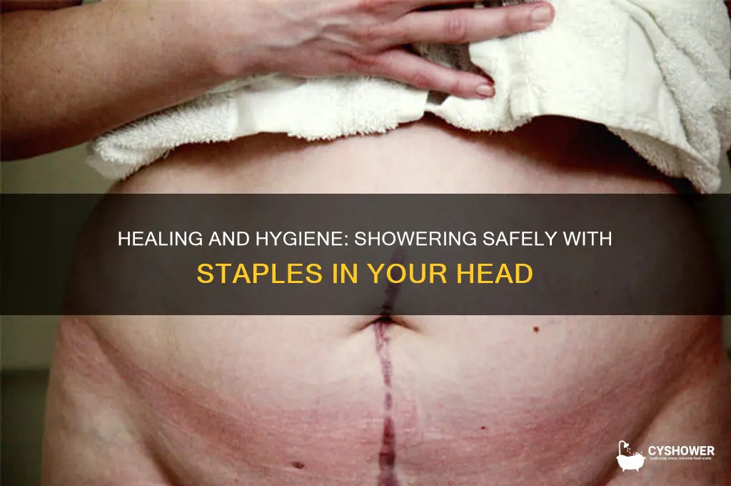 how to shower with staples in head