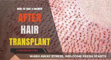 Post-Hair Transplant Shower Guide: Gentle Care for Optimal Healing