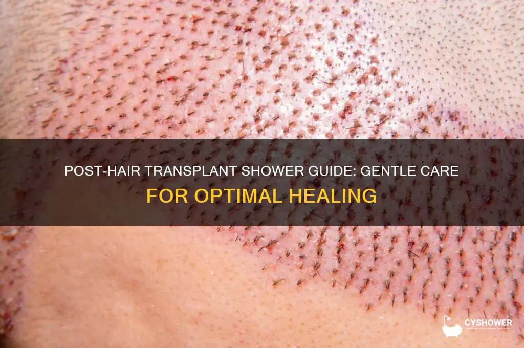 how to take a shower after hair transplant