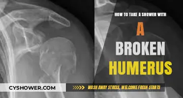 Showering Safely: Tips for Bathing with a Broken Humerus