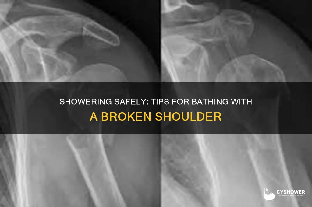 how to take a shower with a broken shoulder