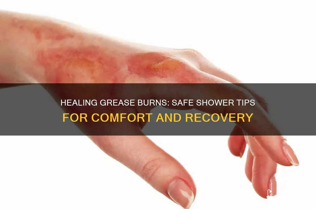 how to take a shower with a grease burn