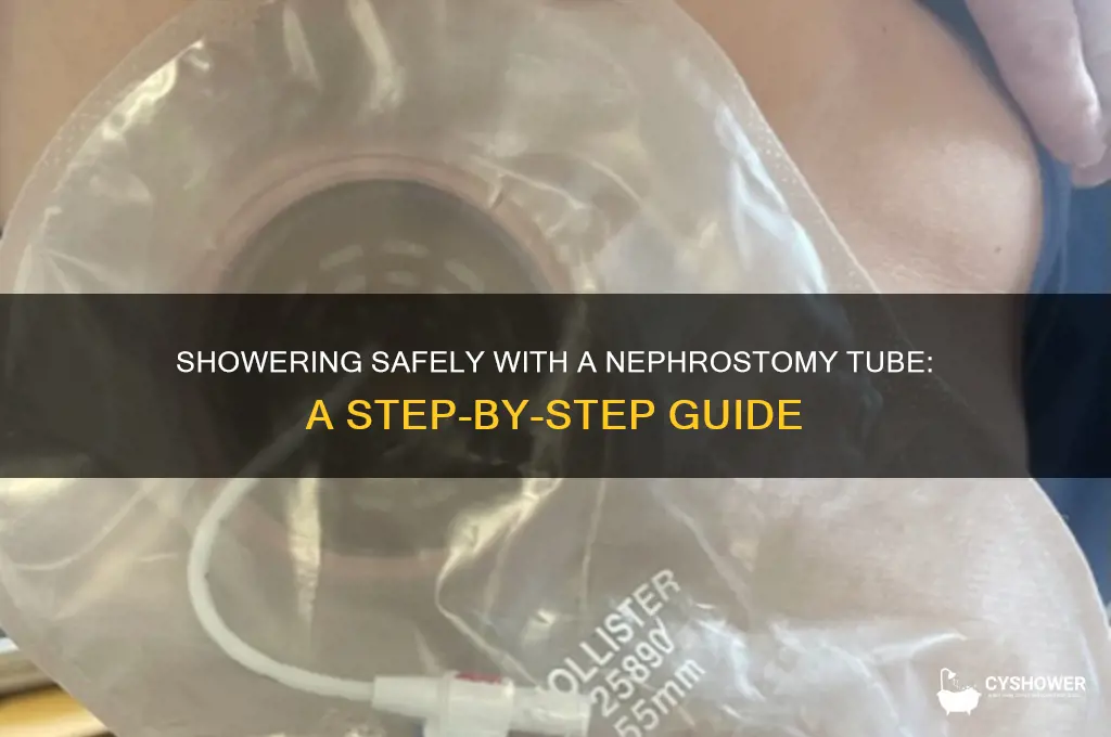 how to take a shower with a nephrostomy tube