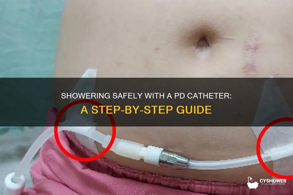 how to take a shower with a pd catheter