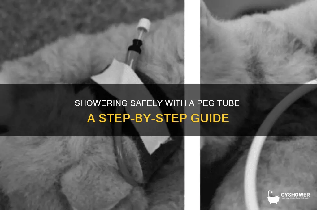 how to take a shower with a peg tube
