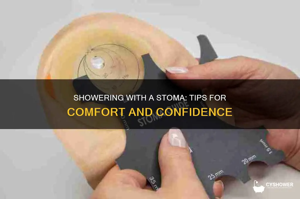 how to take a shower with a stoma
