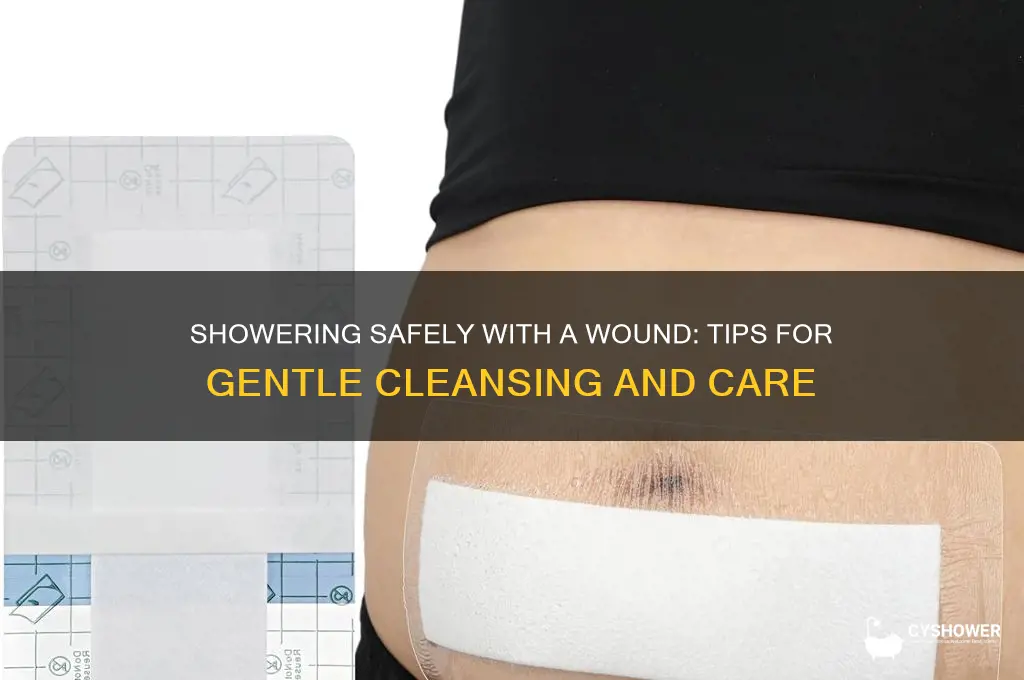 how to take a shower with a wound