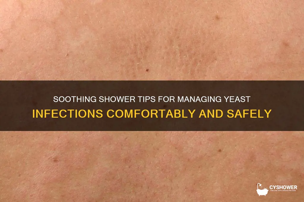 how to take a shower with a yeast infection