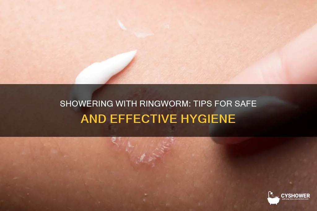 how to take a shower with ringworm