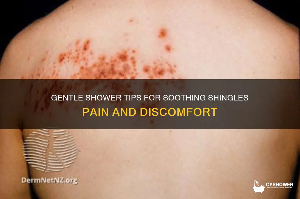 how to take a shower with shingles