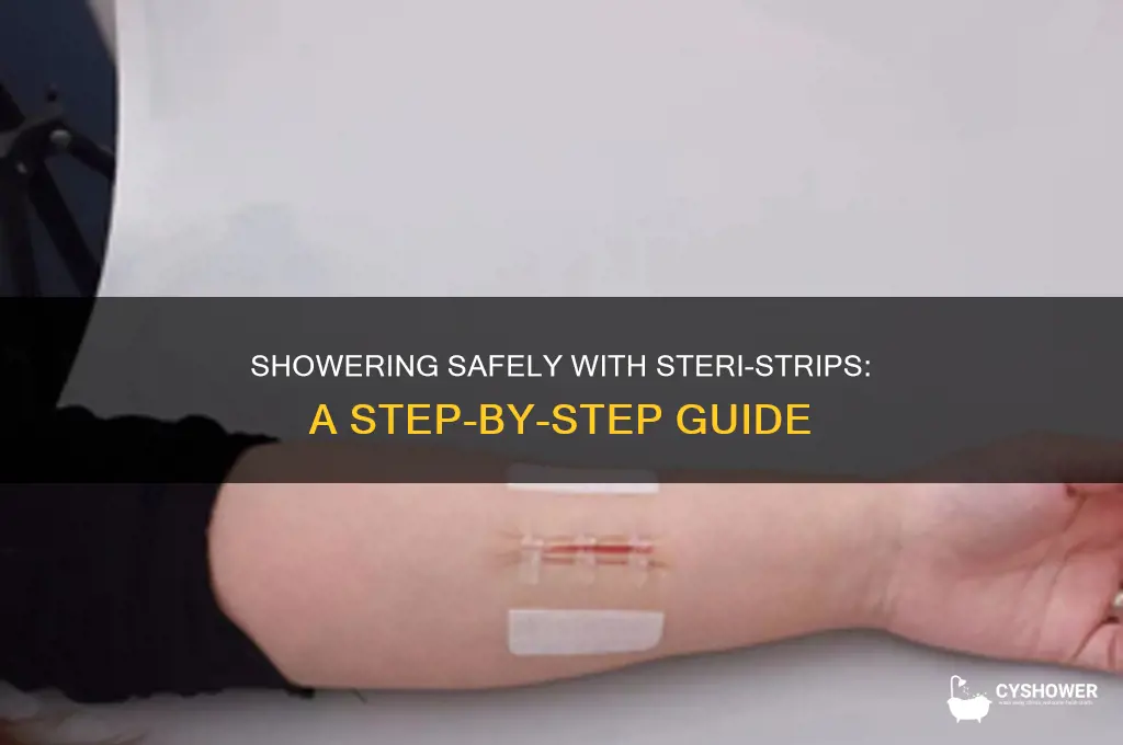 how to take a shower with steri strips