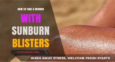 Soothing Sunburn Blisters: Gentle Shower Tips for Healing and Relief