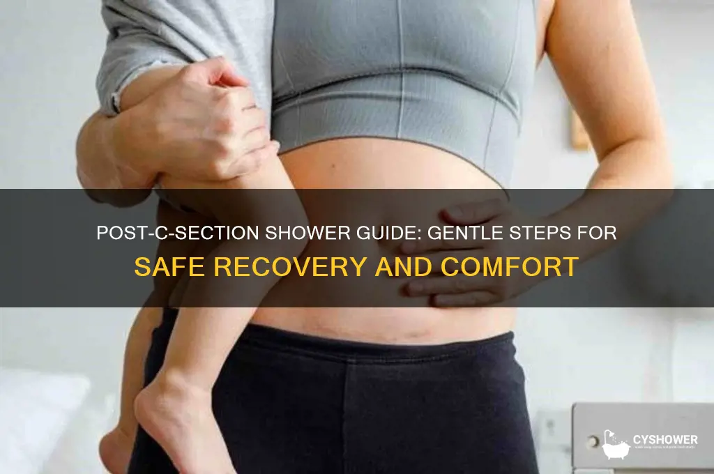 how to take shower after c section