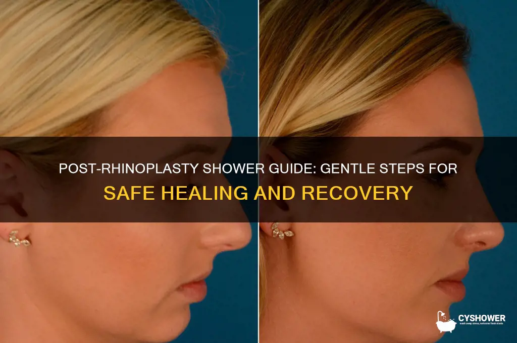 how to take shower after rhinoplasty
