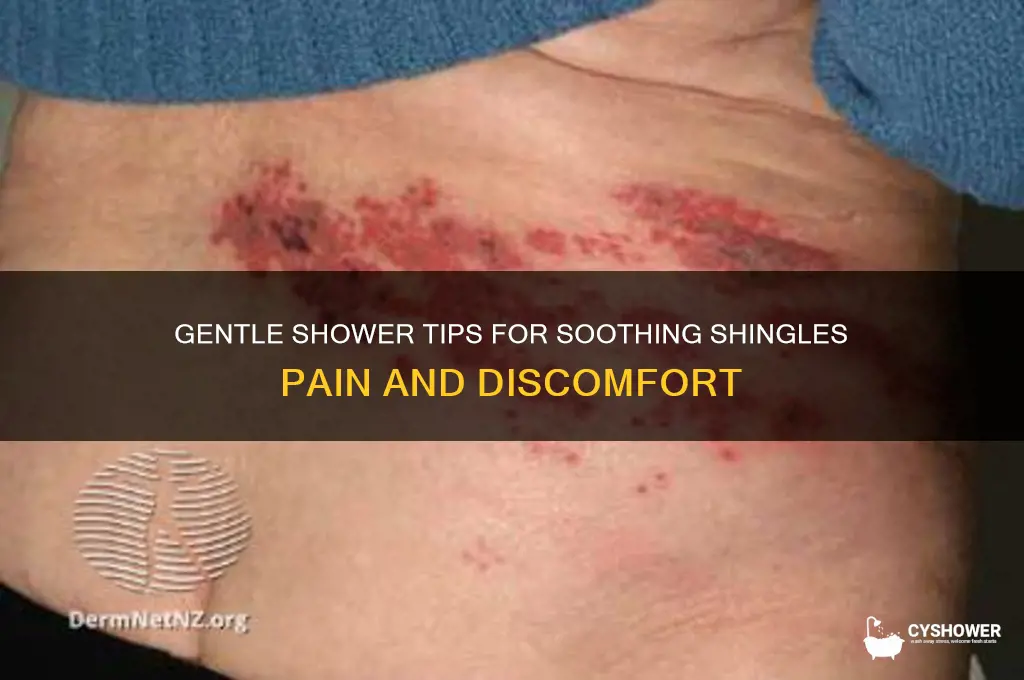 how to take shower with shingles