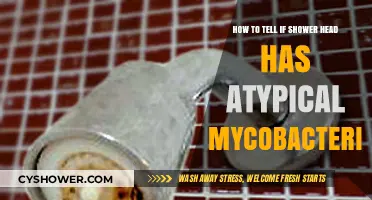 Identifying Atypical Mycobacteria in Your Shower Head: A Quick Guide