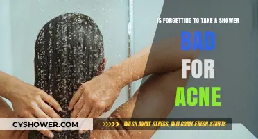 Skipping Showers: Impact on Acne and Skin Health Explained