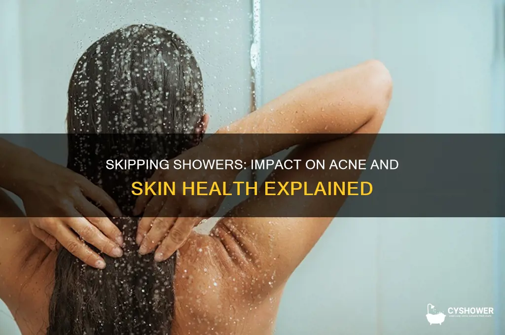 is forgetting to take a shower bad for acne