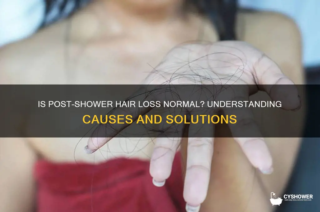 is hair loss after shower normal